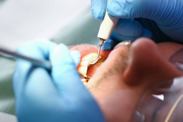 Best Weekend Emergency Dentist in Red Springs, NC