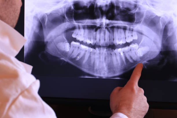 Best Broken or Cracked Tooth Emergency Dentist in Red Springs, NC