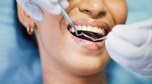 Best Mobile Emergency Dentist in Red Springs, NC
